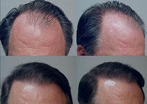 ZED Bitkisel Satreetha Şampuan, Tüm Saç tipleri için %100 Bitkisel Kepek Önleyici Saç Dökülmesi Bakım Ürünü-300ML