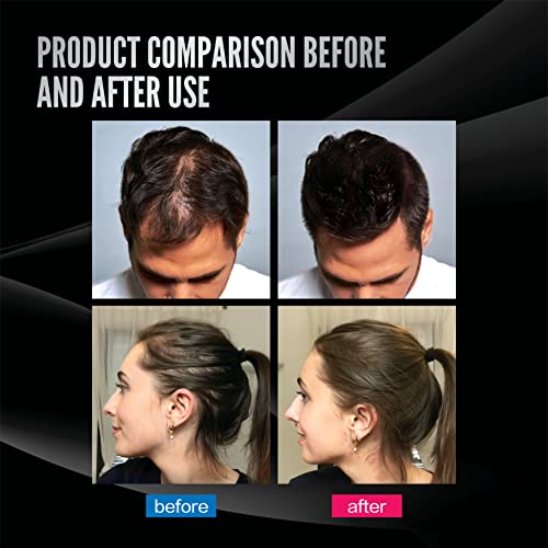 KTTK Patentli ürün - saç bina kalınlaştırıcı toz lifler ve dolgu maddeleri kadınlar ve erkekler için saçları inceltmek için toz